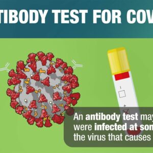 Antibody Test for COVID-19