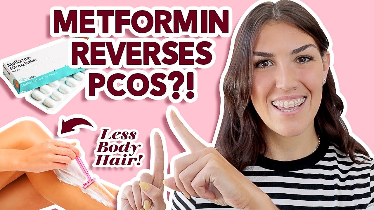 Metformin For PCOS (Polycystic Ovarian Syndrome TREATMENT + Pros And