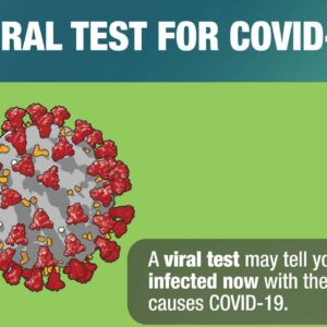Viral Test for COVID-19